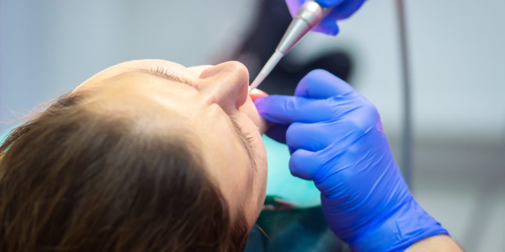 Dental sedation on patient