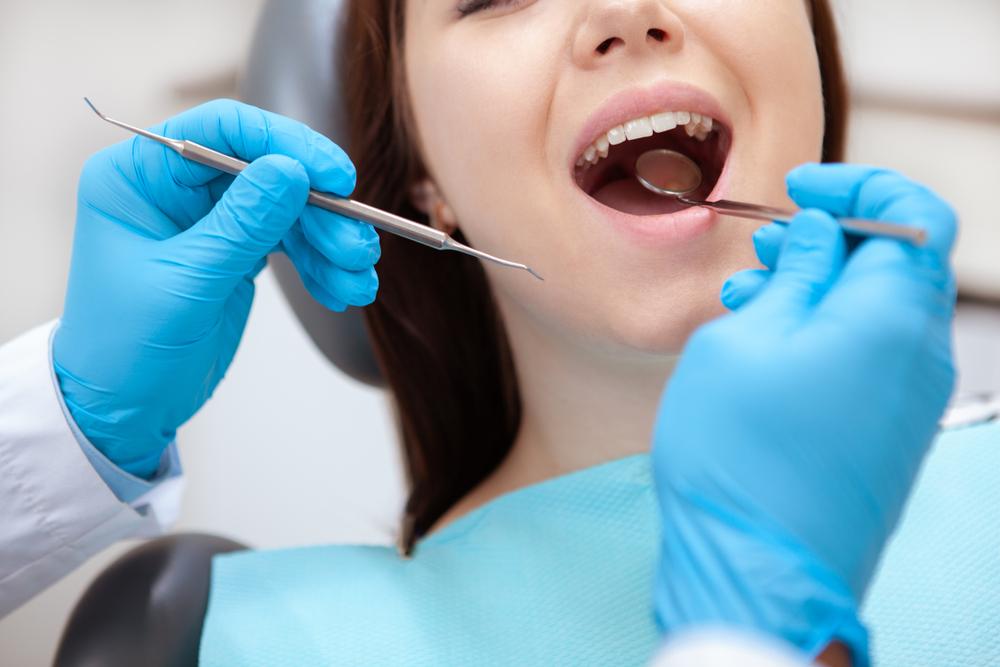 Cropped,Close,Up,Of,A,Female,Patient,With,Healthy,Teeth Cropped Close Up Of A Female Patient With Healthy Teeth