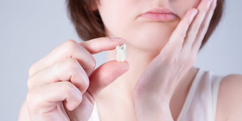 woman holding tooth after wisdom teeth extraction