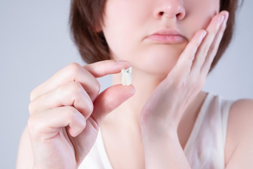 woman holding tooth after wisdom teeth extraction